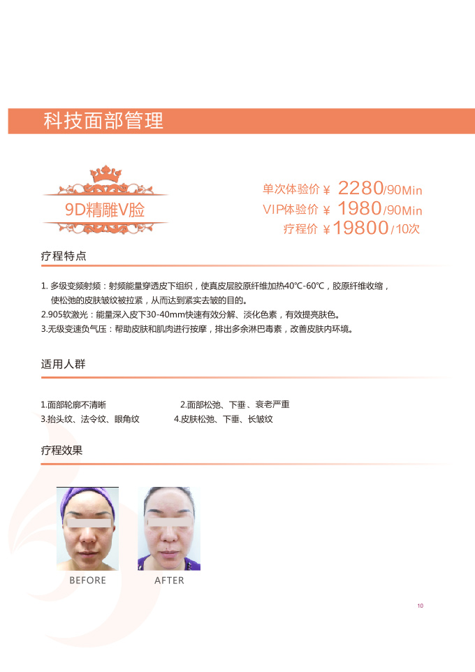9D精雕V臉