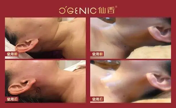 美容哪家好 美容哪家好
